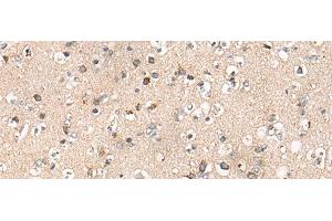 Immunohistochemistry of paraffin-embedded Human brain tissue using C14orf2 Polyclonal Antibody at dilution of 1:60(x200) (C14orf2 Antikörper)