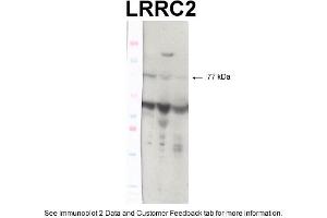 WB Suggested Anti-TP53 Antibody Titration: 0. (LRRC2 Antikörper  (N-Term))