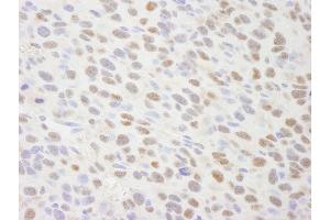 Immunohistochemistry (IHC) image for anti-Tripartite Motif Containing 24 (TRIM24) (AA 700-750) antibody (ABIN7448834) (TRIM24 Antikörper  (AA 700-750))