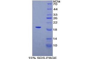 SDS-PAGE analysis of Human ADRA1A Protein. (alpha 1 Adrenergic Receptor Protein)