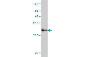 Western Blotting (WB) image for anti-Protein Phosphatase 3, Catalytic Subunit, beta Isozyme (PPP3CB) (AA 435-524) antibody (ABIN562356)
