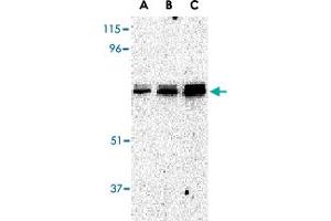 Western blot analysis of EIF2AK2 in A-431 whole cell lysate with EIF2AK2 polyclonal antibody  at (A) 0. (EIF2AK2 Antikörper  (C-Term))