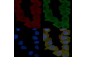 ABIN6261989 and ABIN6269005 staining Hela cells(30 min of UV treatment) by IF/ICC.