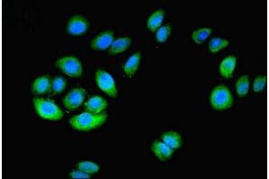 Immunofluorescent analysis of A549 cells using ABIN7149376 at dilution of 1:100 and Alexa Fluor 488-congugated AffiniPure Goat Anti-Rabbit IgG(H+L) (NT5C1A Antikörper  (AA 1-368))