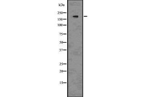 Western blot analysis of BRG1 using 293 whole cell lysates (SMARCA4 Antikörper  (N-Term))