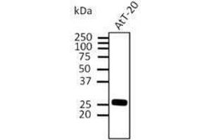 RAB3A Antikörper  (C-Term)