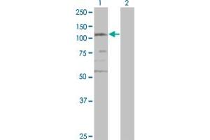 Western Blot analysis of SMC3 expression in transfected 293T cell line by CSPG6 monoclonal antibody (M02), clone 2F11. (SMC3 Antikörper  (AA 711-810))