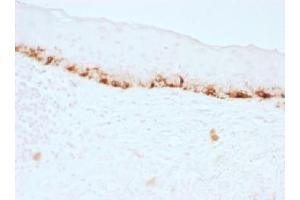 IHC testing of FFPE human skin stained with MART-1 antibody (clone M2-7C10). (MLANA Antikörper)