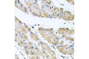 Immunohistochemistry of paraffin-embedded human stomach using OGFR antibody (ABIN5974255) at dilution of 1/100 (40x lens). (OGFR Antikörper)
