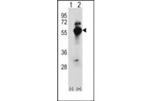 Western blot analysis of DARS (arrow) using DARS1 Antibody (N-term) Cat. (DARS Antikörper  (N-Term))