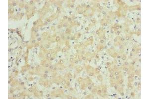 Immunohistochemistry (IHC) image for anti-Ubiquinol-Cytochrome C Reductase Core Protein I (UQCRC1) (AA 156-480) antibody (ABIN7149102)