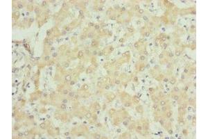 Immunohistochemistry of paraffin-embedded human liver tissue using ABIN7149102 at dilution of 1:100 (UQCRC1 Antikörper  (AA 156-480))