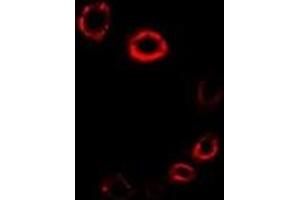 Immunofluorescent analysis of HMGCR staining in A549 cells.
