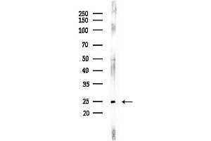 anti-Translin (TSN) (Internal Region) antibody