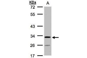 WB Image Sample(30 ug whole cell lysate) A:H1299 10% SDS PAGE antibody diluted at 1:1000 (C4orf19 Antikörper)