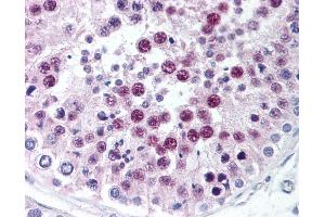 Anti-SIRT1 antibody IHC of human testis. (SIRT1 Antikörper  (C-Term))
