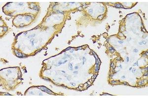 Immunohistochemistry of paraffin-embedded Human placenta using ALPP Polyclonal Antibody at dilution of 1:100 (40x lens). (PLAP Antikörper)