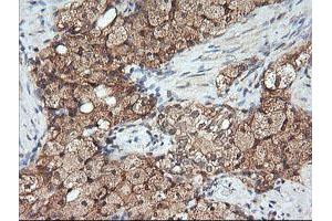 Image no. 5 for anti-Mitogen-Activated Protein Kinase Kinase 1 (MAP2K1) antibody (ABIN1499388) (MEK1 Antikörper)