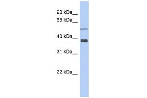 WB Suggested Anti-SS18L1 Antibody Titration: 0. (SS18L1 Antikörper  (Middle Region))