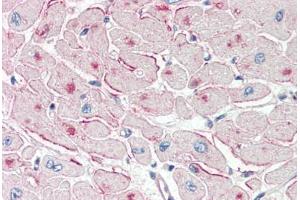 Human Heart (formalin-fixed, paraffin-embedded) stained with PNPLA2 antibody ABIN337131 at 2. (PNPLA2 Antikörper  (AA 68-79))