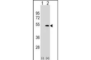 Western Blotting (WB) image for anti-Lymphatic Vessel Endothelial Hyaluronan Receptor 1 (LYVE1) (AA 46-77), (N-Term) antibody (ABIN388751)