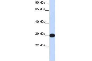 WB Suggested Anti-PPP4C Antibody Titration: 0. (PPP4C Antikörper  (Middle Region))