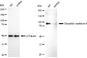 Western blotting analysis using dipeptidyl peptidase 9 antibody (ABIN7798347). (DPP9 Antikörper)