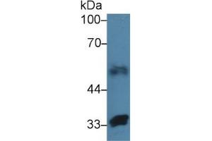 Rabbit Capture antibody from the kit in WB with Positive Control: Sample Human lung lysate. (FBLN4 ELISA Kit)