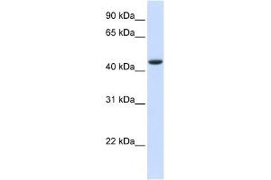 TRDMT1 antibody used at 1 ug/ml to detect target protein.