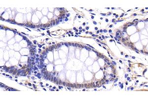 Immunohistochemistry (IHC) image for anti-Matrix Metallopeptidase 7 (Matrilysin, Uterine) (MMP7) (AA 1-267) antibody (ABIN7431014)