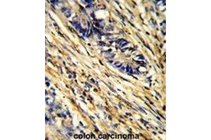 Immunohistochemistry (IHC) image for anti-14-3-3 gamma (YWHAG1) antibody (ABIN3001731) (14-3-3 gamma Antikörper)