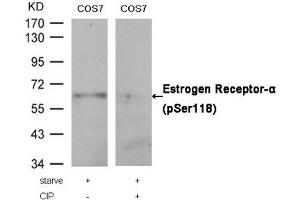 Western blot analysis of extracts from COS7 cells, treated with starve or calf intestinal phosphatase (CIP), using Estrogen Receptor-α (Phospho-Ser118) Antibody. (Estrogen Receptor alpha Antikörper  (pSer118))