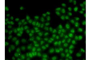 Immunofluorescence analysis of HeLa cells using ID3 antibody. (ID3 Antikörper)