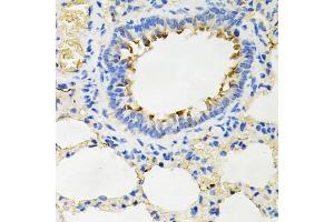 Immunohistochemistry of paraffin-embedded rat lung using IRAK2 antibody (ABIN5971467) at dilution of 1/100 (40x lens).