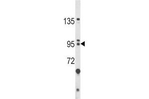 Western Blotting (WB) image for anti-Bicaudal C Homolog 1 (BICC1) antibody (ABIN3002907) (BICC1 Antikörper)