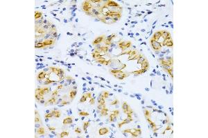 Immunohistochemistry of paraffin-embedded human stomach using CYP2E1 antibody (ABIN3023078, ABIN3023079, ABIN3023080 and ABIN6219379) at dilution of 1:100 (40x lens). (CYP2E1 Antikörper  (AA 234-493))