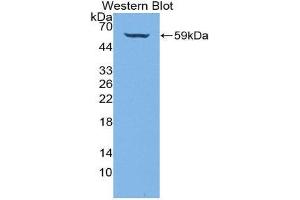 Western Blotting (WB) image for anti-Collagen, Type IV, alpha 3 (COL4A3) (AA 1428-1670) antibody (ABIN3205410)