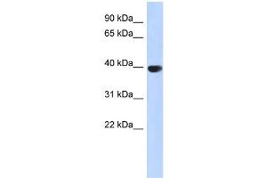 WB Suggested Anti-AURKC Antibody Titration: 0. (Aurora Kinase C Antikörper  (Middle Region))