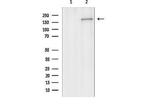 anti-ATP-Binding Cassette, Sub-Family C (CFTR/MRP), Member 1 (ABCC1) (N-Term) antibody