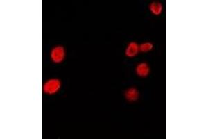 Immunofluorescent analysis of HRP2 staining in A549 cells.