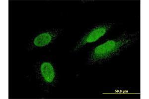 Immunofluorescence of monoclonal antibody to TTN on HeLa cell. (Titin Antikörper  (AA 1-110))