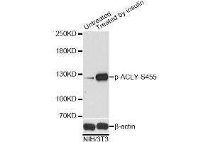 Western blot analysis of extracts of NIH/3T3 cells,using Phospho-ACLY-S455 antibody. (ACLY Antikörper  (pSer455))