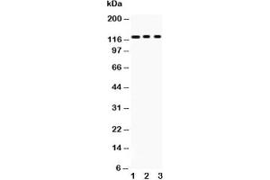 Western blot testing of PLD1 antibody and Lane 1:  mouse heart;  2: 22RV1;  3: HeLa;  Predicted size: 124KD;  Observed size: 124KD (PLD1 Antikörper  (AA 1-330))