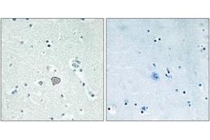 Immunohistochemistry analysis of paraffin-embedded human brain tissue, using ADORA2A Antibody. (Adenosine A2a Receptor Antikörper  (AA 321-370))