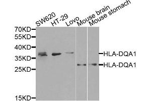 Western blot analysis of extracts of various cells, using HLA-DQA1 antibody. (HLA-DQA1 Antikörper)