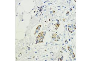 Immunohistochemistry (IHC) image for anti-AKT1 Substrate 1 (Proline-Rich) (AKT1S1) (AA 152-276) antibody (ABIN6136741)