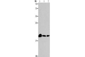Gel: 15 % SDS-PAGE, Lysate: 40 μg, Lane 1-3: Mouse brain tissue, 231 cells, A375 cells, Primary antibody: ABIN7189902(ARL3 Antibody) at dilution 1/433, Secondary antibody: Goat anti rabbit IgG at 1/8000 dilution, Exposure time: 2 minutes (ARL3 Antikörper)