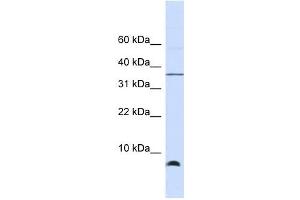 HSPE1 antibody used at 1 ug/ml to detect target protein. (HSPE1 Antikörper)