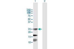Western Blot analysis of FXN expression in transfected 293T cell line by FXN MaxPab polyclonal antibody. (Frataxin Antikörper  (AA 1-210))
