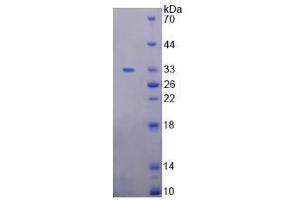 SDS-PAGE analysis of Human Uromodulin Protein.